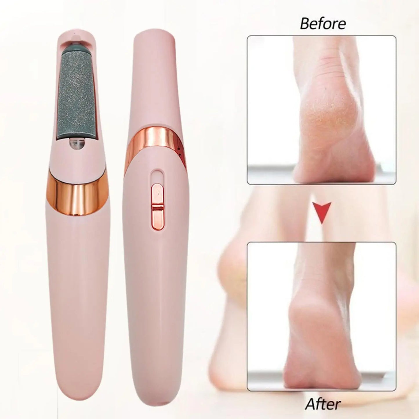 Electric Foot Pedicure - Callus Remover